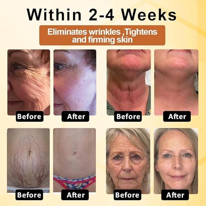 Botox Bee Advanced Multi-Action Firming Cream 200 gm Pack of 2